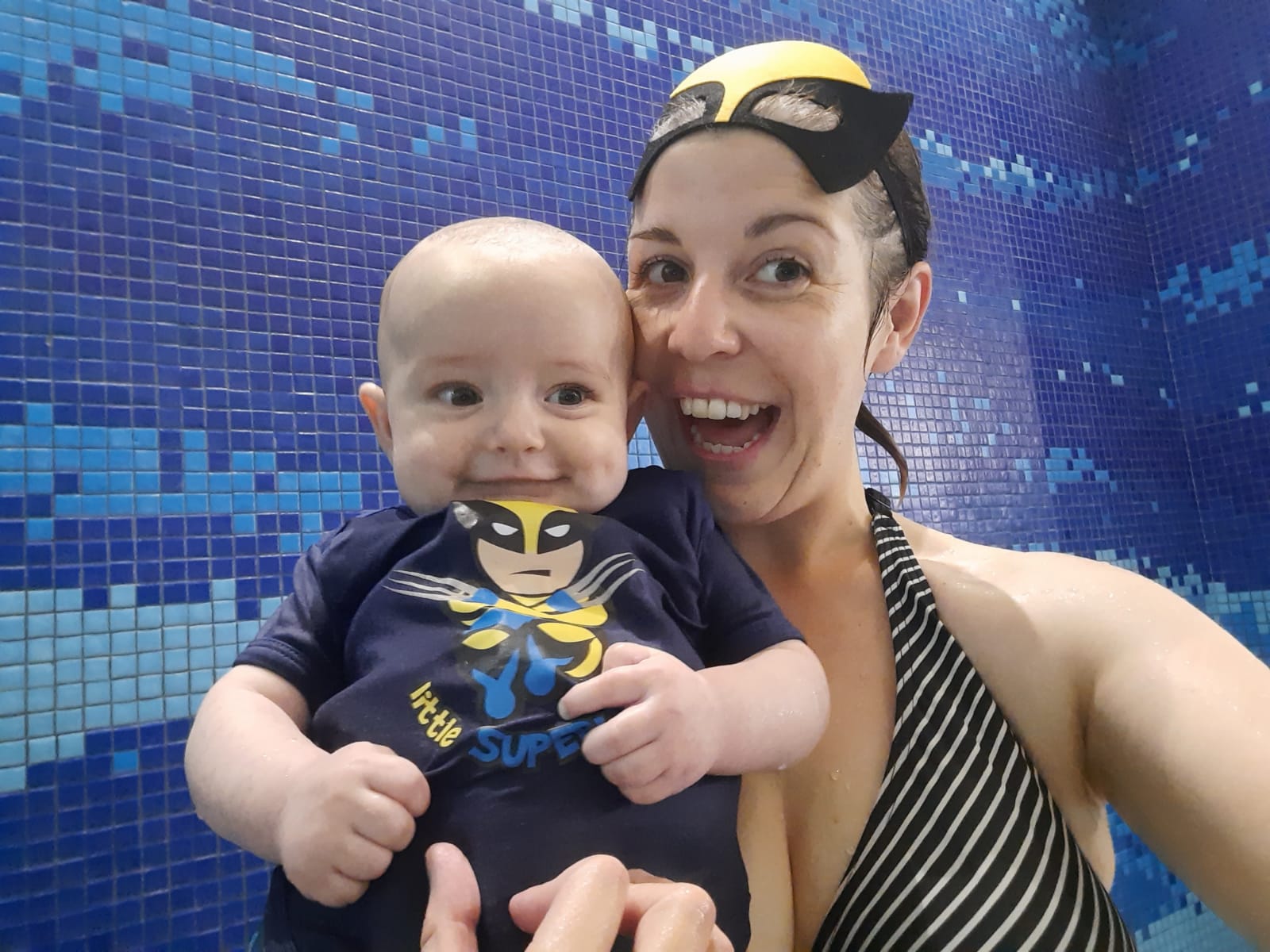 Baby Swimming With Agenesis